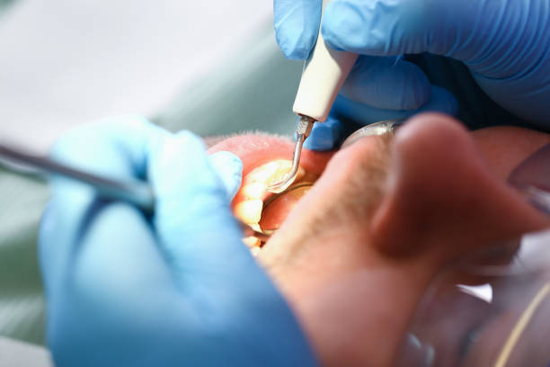 Best Emergency Dental Extractions in Whiteville, NC