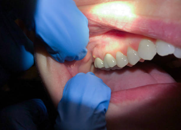 Best Mobile Emergency Dentist in Whiteville, NC