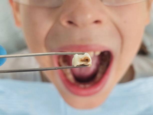 Best Orthodontic Emergency Dentist in Whiteville, NC